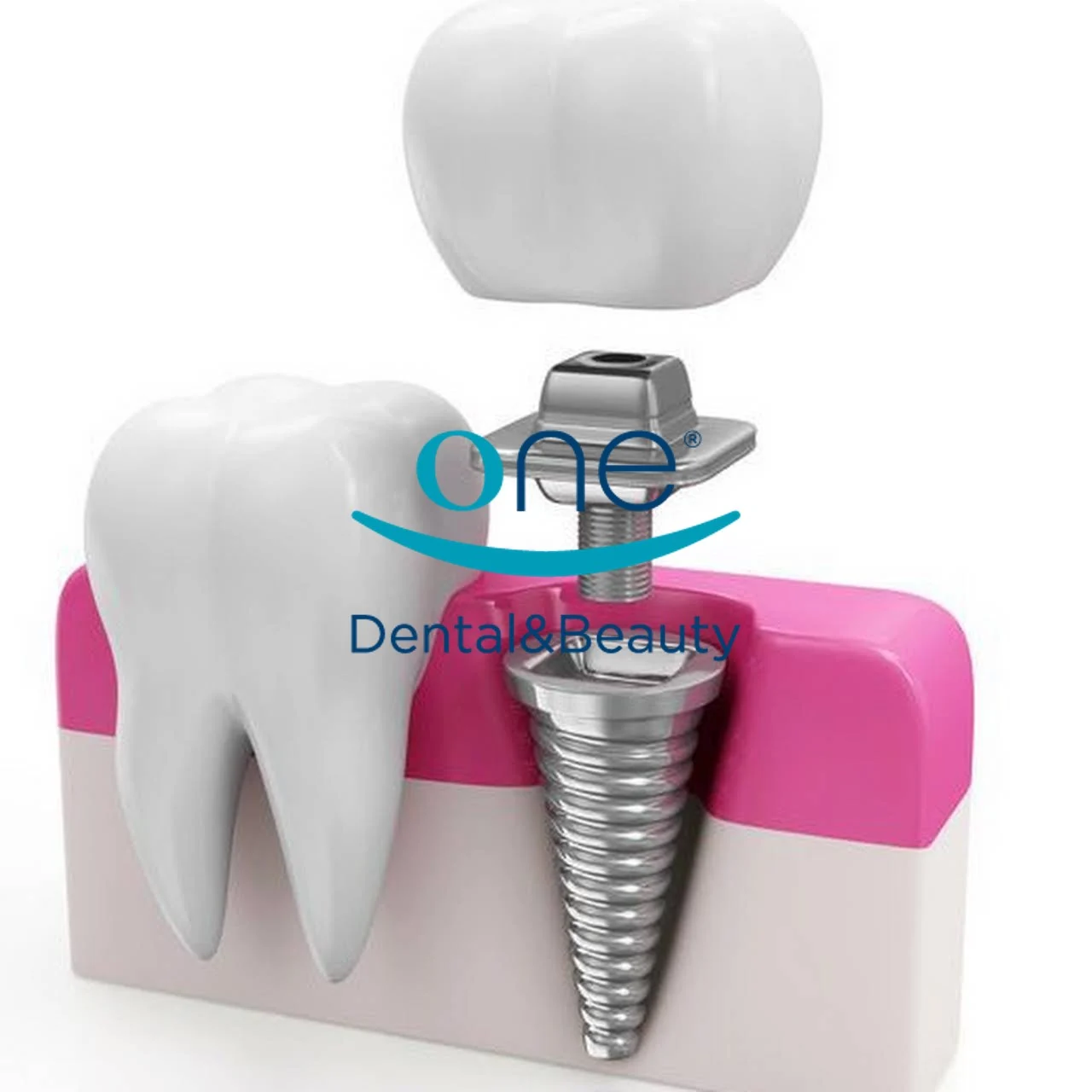 One Dental&Beauty — progetto digitale
